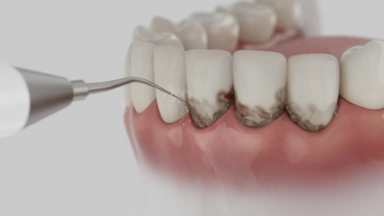 Reliable Emergency Dentist contractor in Naples Park, FL by Smile Center Dentistry